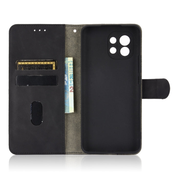 For Xiaomi Mi 11 Solid Color Skin Feel Magnetic Buckle Horizontal Flip Calf Texture PU Leather Case with Holder & Card Slots & Wallet