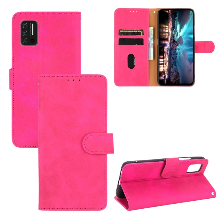 For UMIDIGI A7S Solid Color Skin Feel Magnetic Buckle Horizontal Flip Calf Texture PU Leather Case with Holder & Card Slots & Wallet
