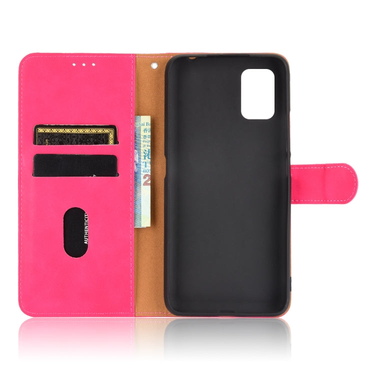 For UMIDIGI A7S Solid Color Skin Feel Magnetic Buckle Horizontal Flip Calf Texture PU Leather Case with Holder & Card Slots & Wallet