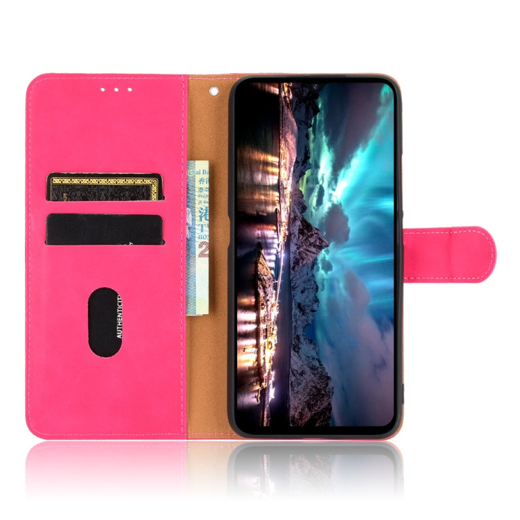For UMIDIGI A7S Solid Color Skin Feel Magnetic Buckle Horizontal Flip Calf Texture PU Leather Case with Holder & Card Slots & Wallet