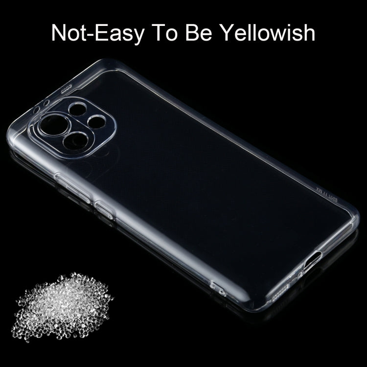 For Xiaomi Mi 11 0.75mm Ultra-thin Transparent TPU Soft Protective Case