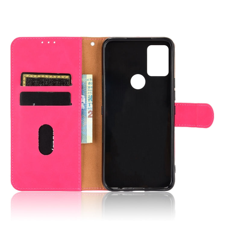For UMIDIGI A9 Pro Solid Color Skin Feel Magnetic Buckle Horizontal Flip Calf Texture PU Leather Case with Holder & Card Slots & Wallet