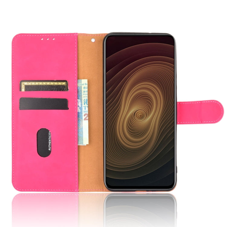 For ZTE Axon 20 5G / A20 5G Solid Color Skin Feel Magnetic Buckle Horizontal Flip Calf Texture PU Leather Case with Holder & Card Slots & Wallet