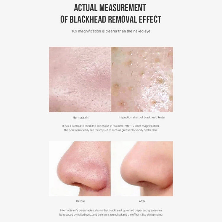 V100 AI Intelligent Visible Electric Blackhead Suction Instrument Pore Cleaner