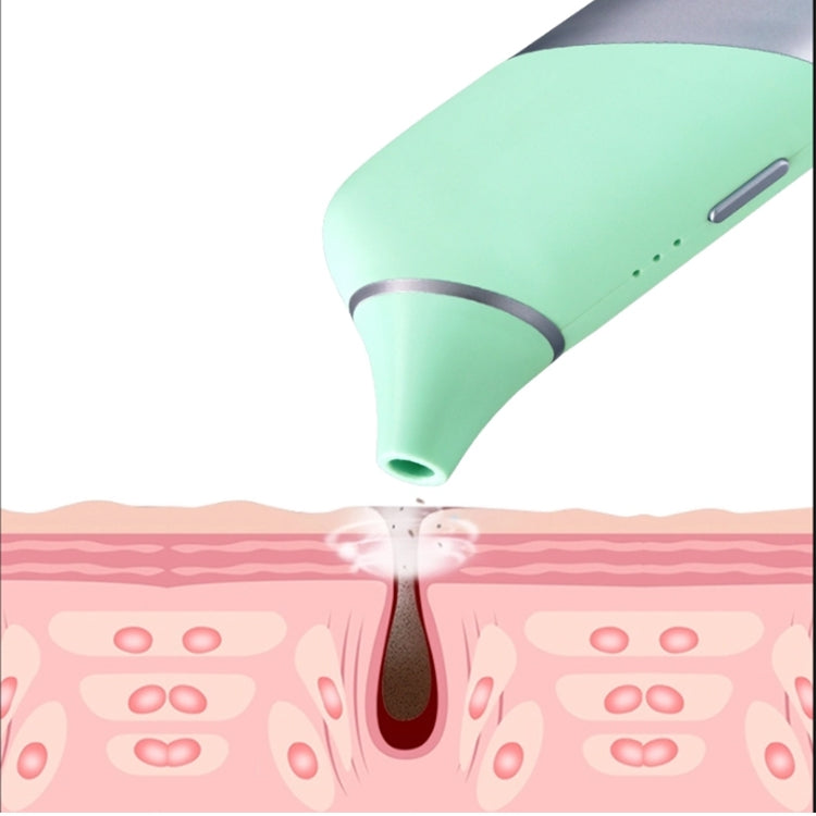 V100 AI Intelligent Visible Electric Blackhead Suction Instrument Pore Cleaner