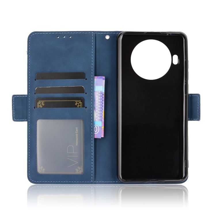 For Cubot Note 20 / Note 20 Pro Skin Feel Calf Texture Horizontal Flip Leather Case with Holder & Card Slots & Photo Frame
