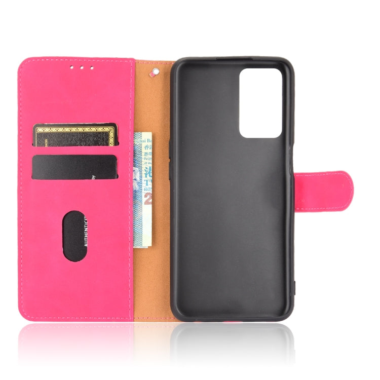 For OPPO A55 5G Solid Color Skin Feel Magnetic Buckle Horizontal Flip Calf Texture PU Leather Case with Holder & Card Slots & Wallet