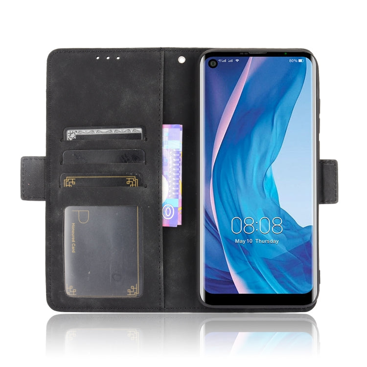 For Ulefone Note 11P Skin Feel Calf Pattern Horizontal Flip Leather Case with Holder & Card Slots & Photo Frame