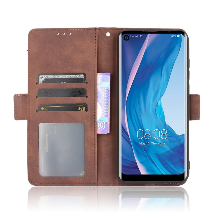 For Ulefone Note 11P Skin Feel Calf Pattern Horizontal Flip Leather Case with Holder & Card Slots & Photo Frame