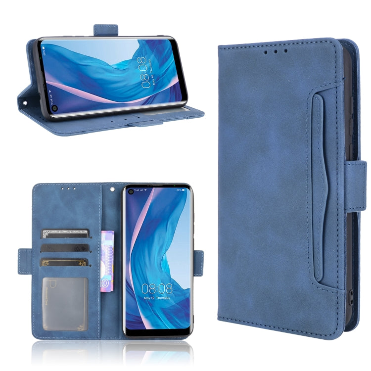 For Ulefone Note 11P Skin Feel Calf Pattern Horizontal Flip Leather Case with Holder & Card Slots & Photo Frame