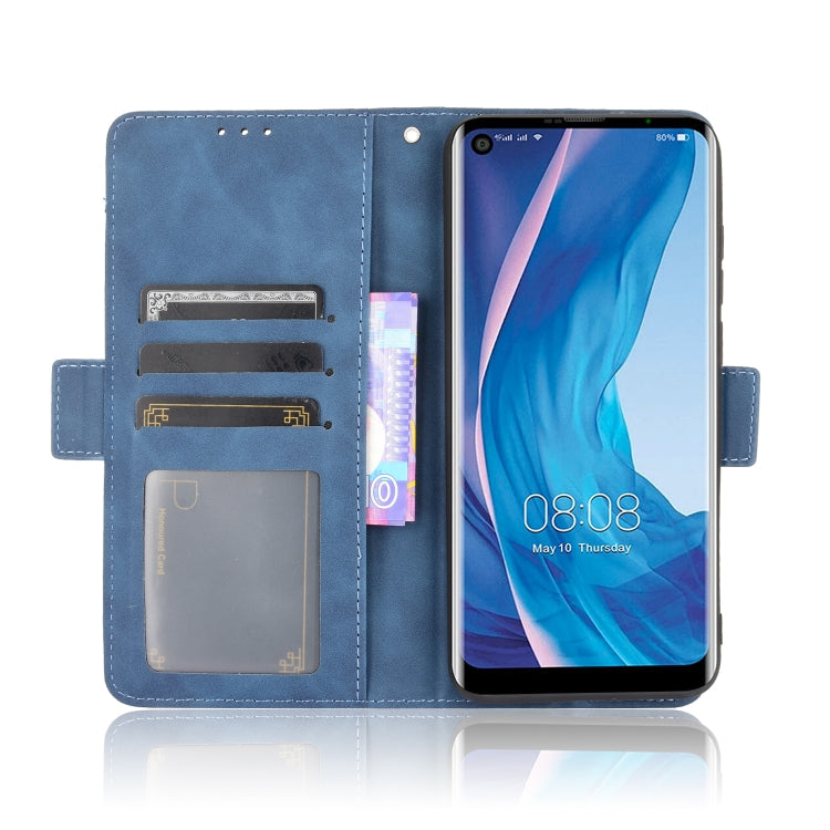 For Ulefone Note 11P Skin Feel Calf Pattern Horizontal Flip Leather Case with Holder & Card Slots & Photo Frame