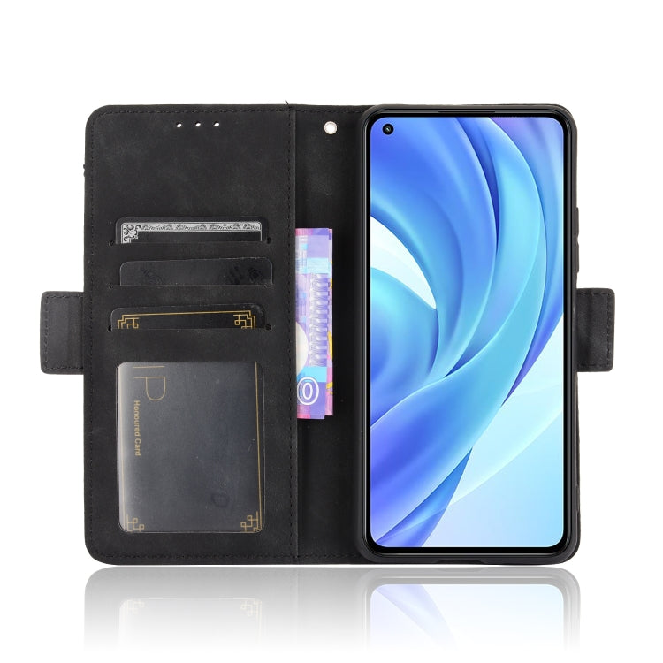For Xiaomi Mi 11 Lite 4G / Mi 11 Lite 5G Skin Feel Calf Pattern Horizontal Flip Leather Case with Holder & Card Slots & Photo Frame