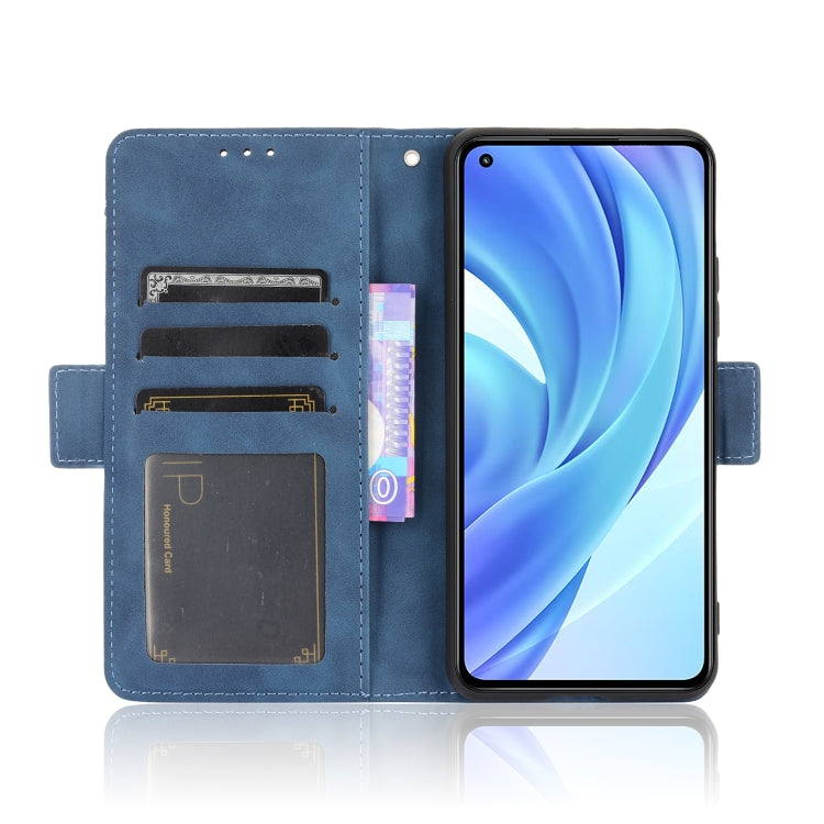 For Xiaomi Mi 11 Lite 4G / Mi 11 Lite 5G Skin Feel Calf Pattern Horizontal Flip Leather Case with Holder & Card Slots & Photo Frame