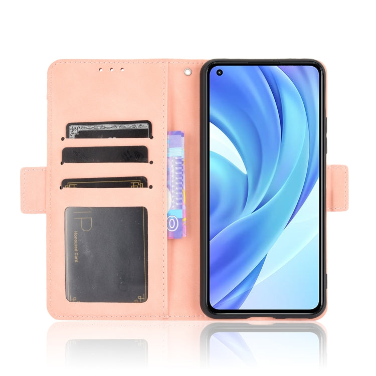 For Xiaomi Mi 11 Lite 4G / Mi 11 Lite 5G Skin Feel Calf Pattern Horizontal Flip Leather Case with Holder & Card Slots & Photo Frame