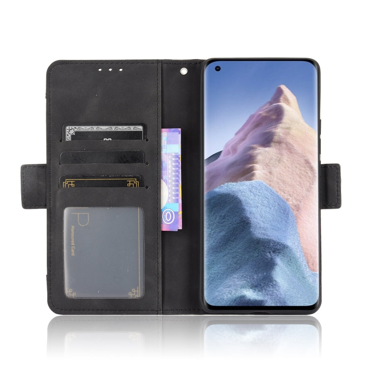 For Xiaomi Mi 11 Ultra Skin Feel Calf Pattern Horizontal Flip Leather Case with Holder & Card Slots & Photo Frame