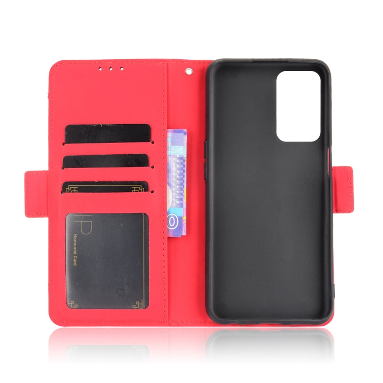 For OPPO A55 5G / A53s 5G Skin Feel Calf Pattern Horizontal Flip Leather Case with Holder & Card Slots & Photo Frame