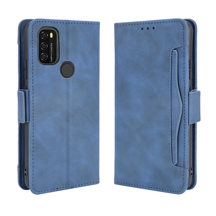 For Blackview A70 (2021) Skin Feel Calf Pattern Horizontal Flip Leather Case with Holder & Card Slots & Photo Frame