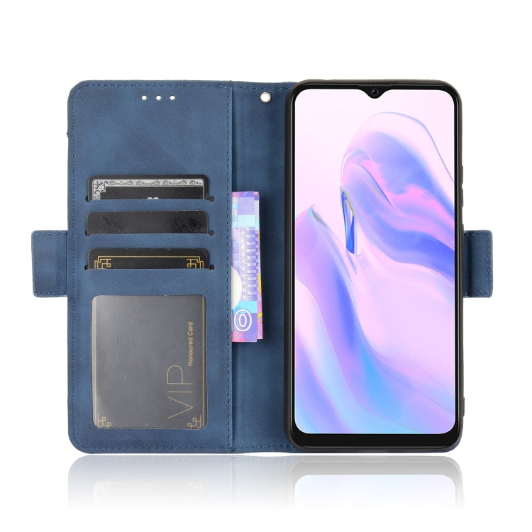 For Blackview A70 (2021) Skin Feel Calf Pattern Horizontal Flip Leather Case with Holder & Card Slots & Photo Frame