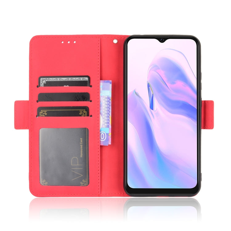 For Blackview A70 (2021) Skin Feel Calf Pattern Horizontal Flip Leather Case with Holder & Card Slots & Photo Frame