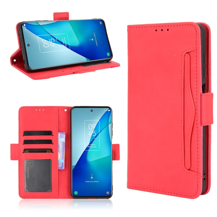 For TCL 20 5G / 20S Skin Feel Calf Pattern Horizontal Flip Leather Case with Holder & Card Slots & Photo Frame
