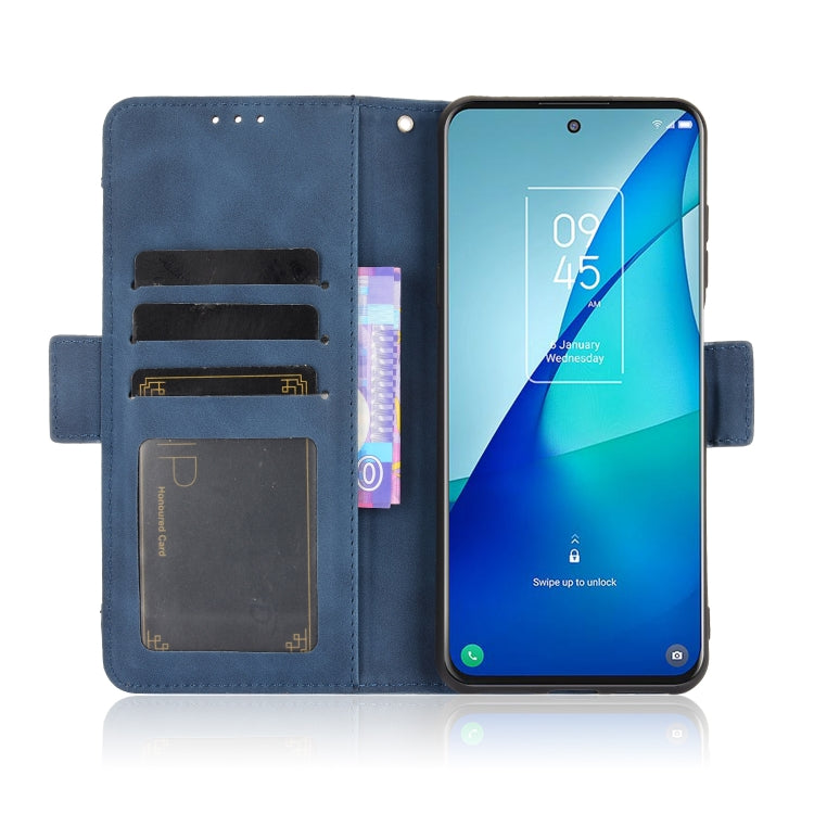 For TCL 20 5G / 20S Skin Feel Calf Pattern Horizontal Flip Leather Case with Holder & Card Slots & Photo Frame