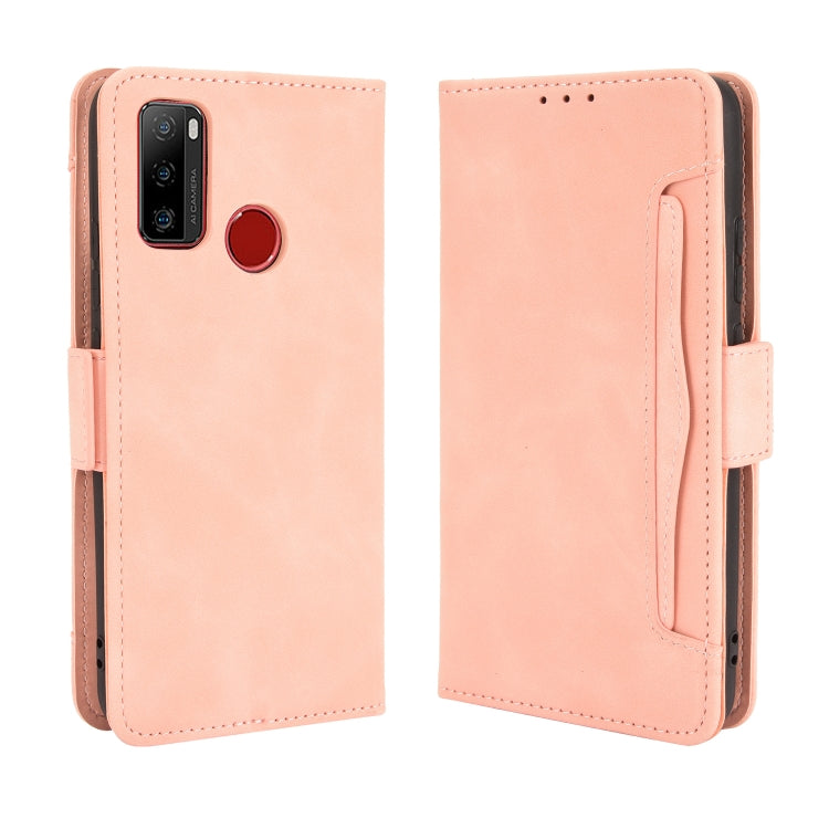 For Ulefone Note 10 Skin Feel Calf Pattern Horizontal Flip Leather Case with Holder & Card Slots & Photo Frame