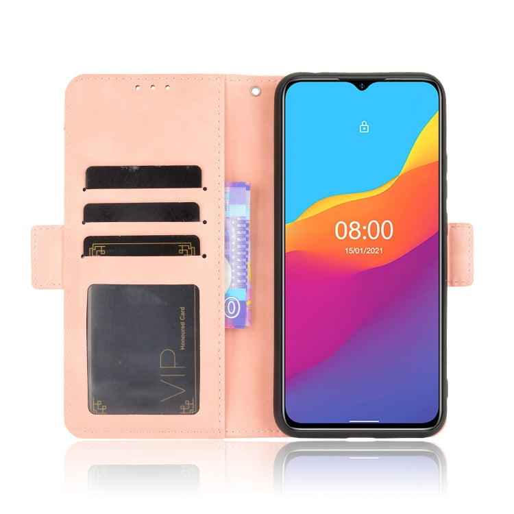 For Ulefone Note 10 Skin Feel Calf Pattern Horizontal Flip Leather Case with Holder & Card Slots & Photo Frame