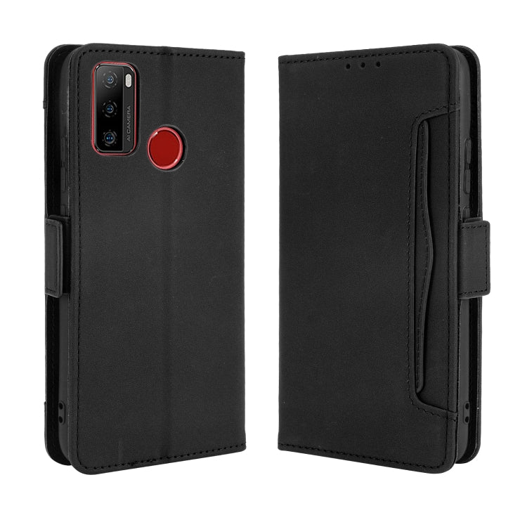 For Ulefone Note 10 Skin Feel Calf Pattern Horizontal Flip Leather Case with Holder & Card Slots & Photo Frame