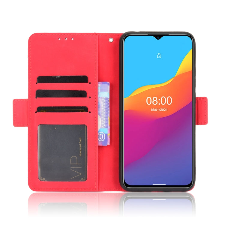 For Ulefone Note 10 Skin Feel Calf Pattern Horizontal Flip Leather Case with Holder & Card Slots & Photo Frame
