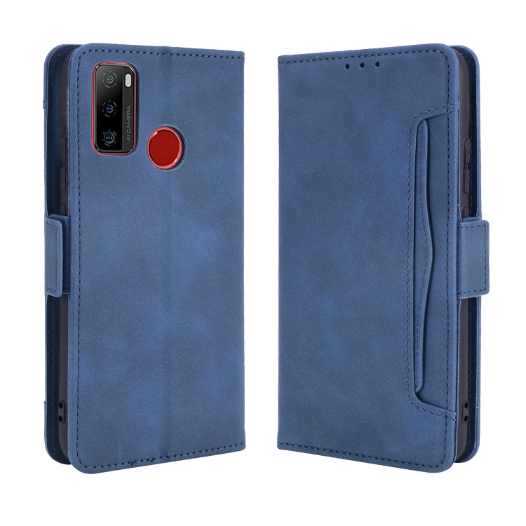 For Ulefone Note 10 Skin Feel Calf Pattern Horizontal Flip Leather Case with Holder & Card Slots & Photo Frame