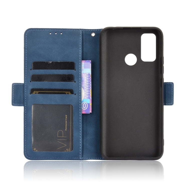 For Ulefone Note 10 Skin Feel Calf Pattern Horizontal Flip Leather Case with Holder & Card Slots & Photo Frame