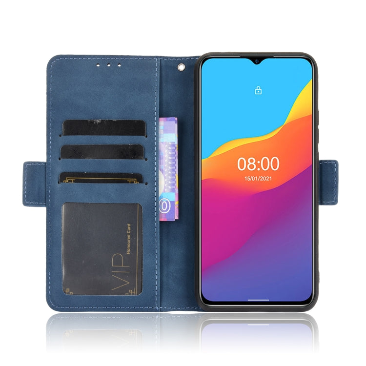 For Ulefone Note 10 Skin Feel Calf Pattern Horizontal Flip Leather Case with Holder & Card Slots & Photo Frame
