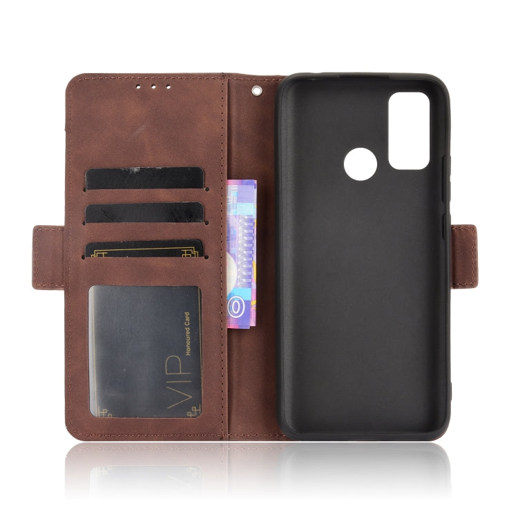 For Ulefone Note 10 Skin Feel Calf Pattern Horizontal Flip Leather Case with Holder & Card Slots & Photo Frame