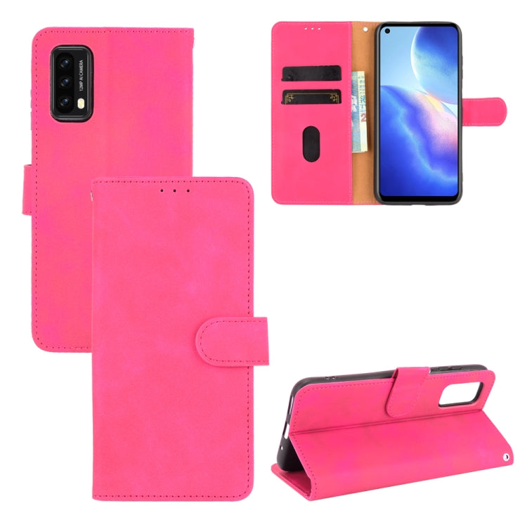 For Blackview A90 Solid Color Skin Feel Magnetic Buckle Horizontal Flip Calf Texture PU Leather Case with Holder & Card Slots & Wallet