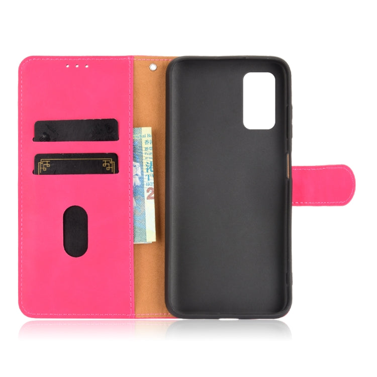 For Blackview A90 Solid Color Skin Feel Magnetic Buckle Horizontal Flip Calf Texture PU Leather Case with Holder & Card Slots & Wallet