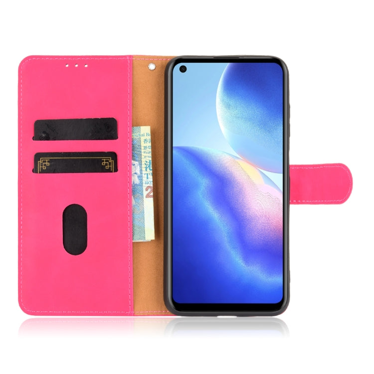 For Blackview A90 Solid Color Skin Feel Magnetic Buckle Horizontal Flip Calf Texture PU Leather Case with Holder & Card Slots & Wallet