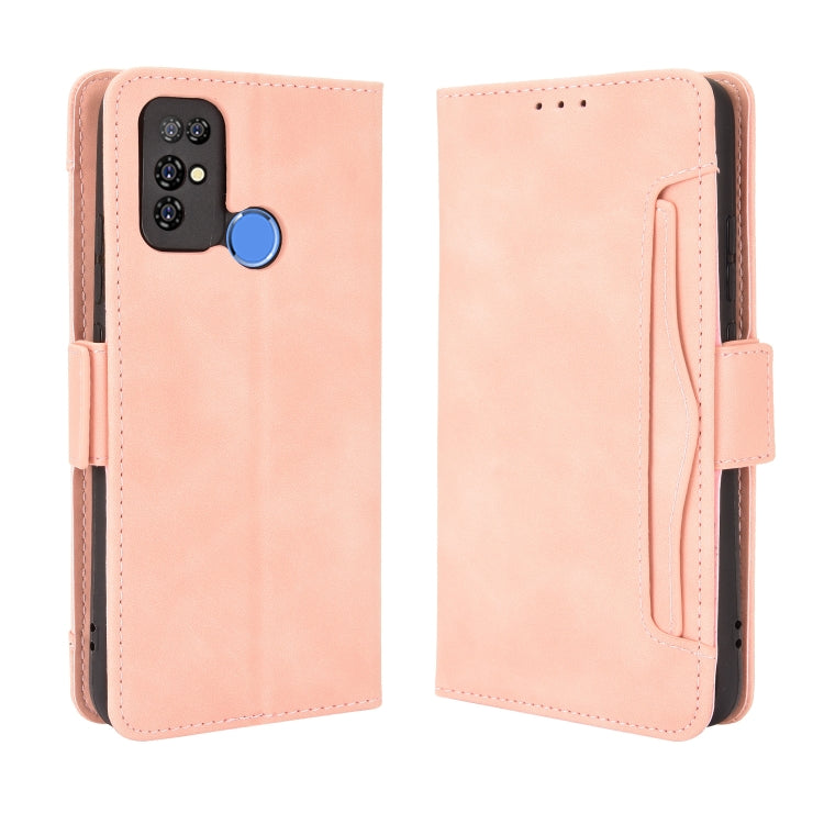 For Doogee X96 Pro Skin Feel Calf Pattern Horizontal Flip Leather Case with Holder & Card Slots & Photo Frame