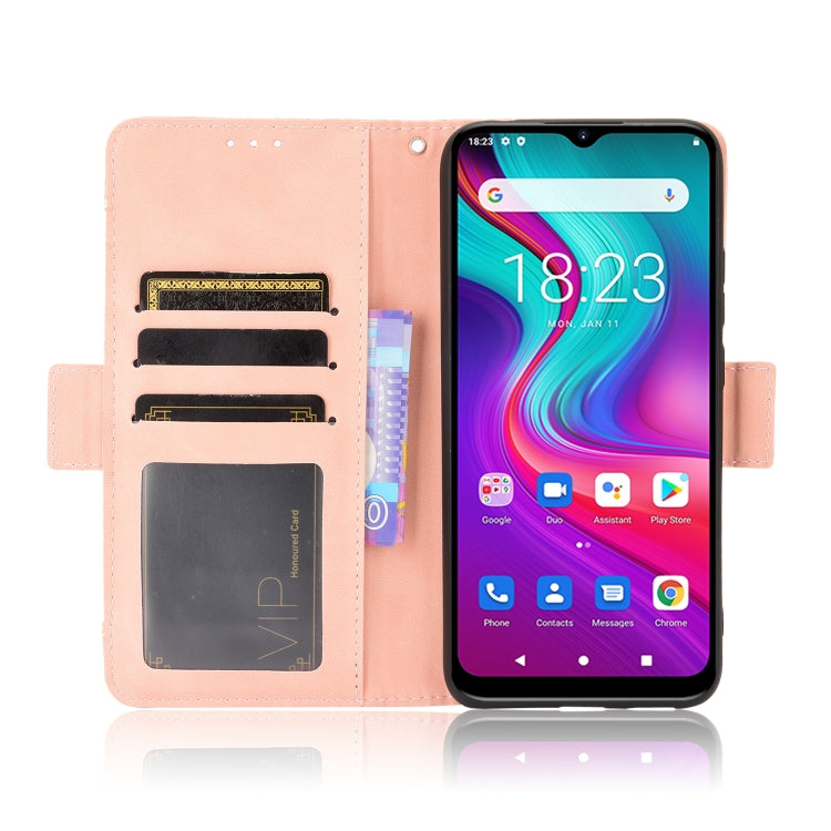 For Doogee X96 Pro Skin Feel Calf Pattern Horizontal Flip Leather Case with Holder & Card Slots & Photo Frame