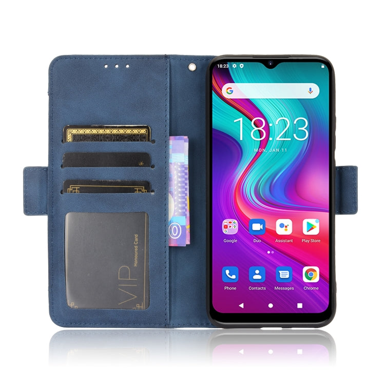 For Doogee X96 Pro Skin Feel Calf Pattern Horizontal Flip Leather Case with Holder & Card Slots & Photo Frame