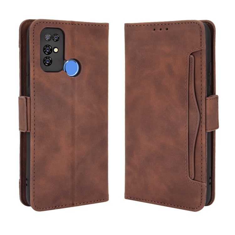 For Doogee X96 Pro Skin Feel Calf Pattern Horizontal Flip Leather Case with Holder & Card Slots & Photo Frame
