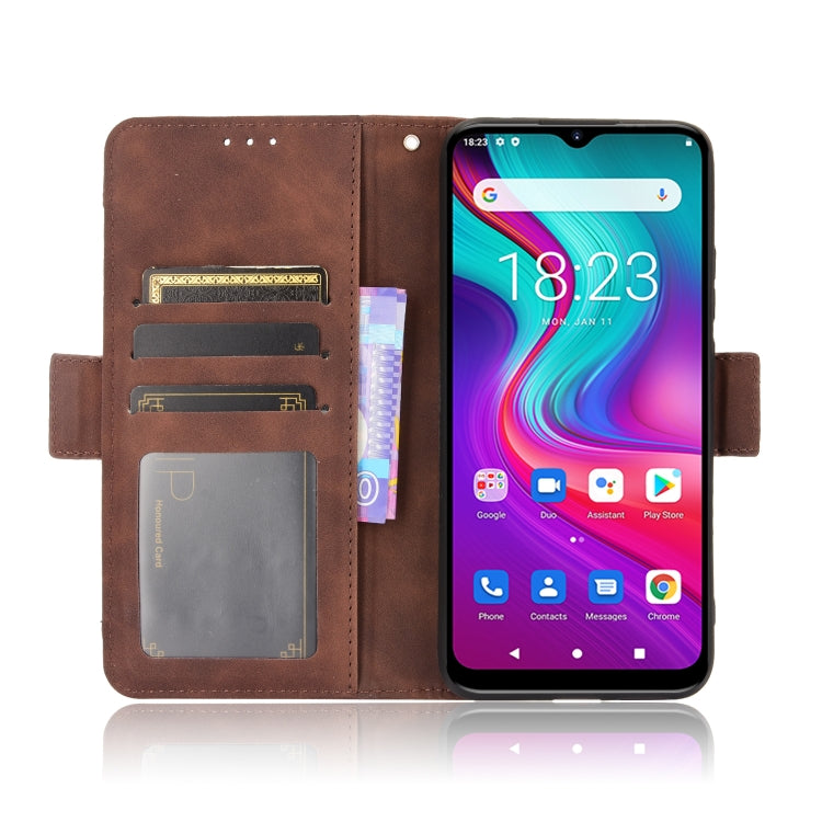 For Doogee X96 Pro Skin Feel Calf Pattern Horizontal Flip Leather Case with Holder & Card Slots & Photo Frame