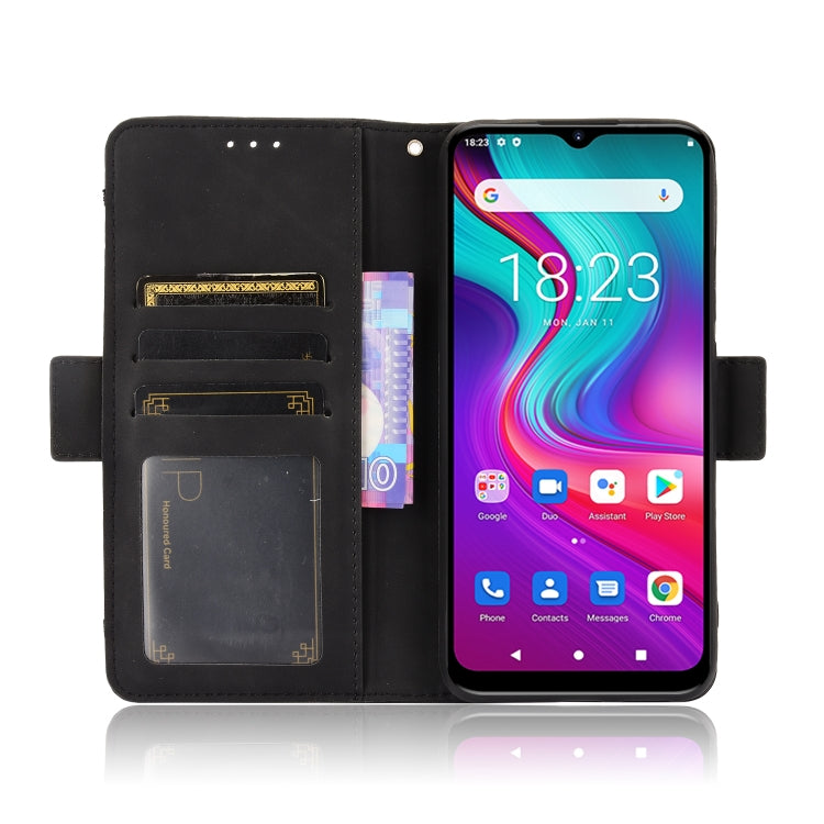 For Doogee X96 Pro Skin Feel Calf Pattern Horizontal Flip Leather Case with Holder & Card Slots & Photo Frame
