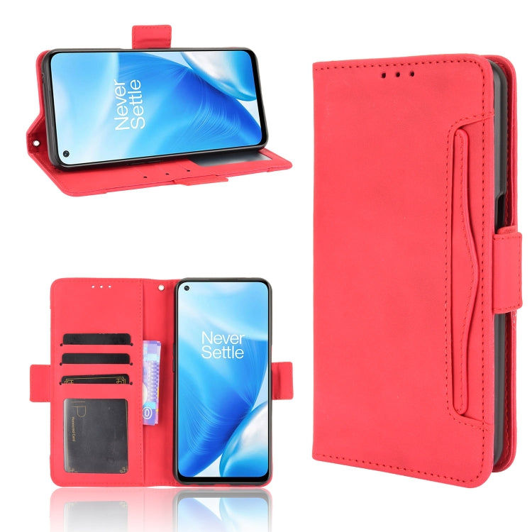 For OnePlus Nord N200 5G Skin Feel Calf Pattern Horizontal Flip Leather Case with Holder & Card Slots & Photo Frame