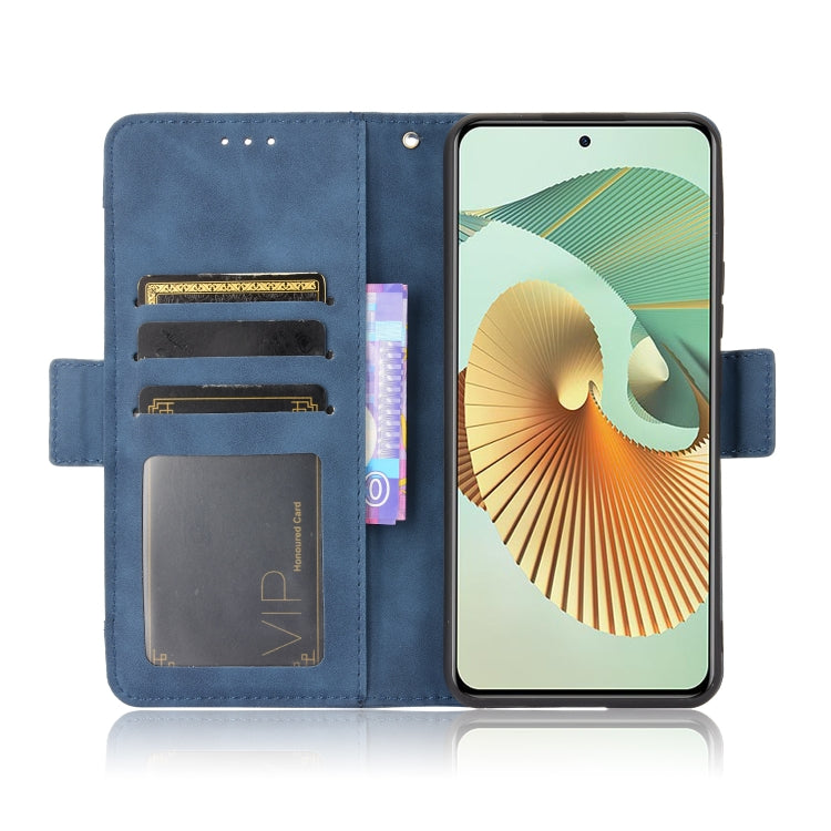 For ZTE Axon 30 Pro 5G Skin Feel Calf Pattern Horizontal Flip Leather Case with Holder & Card Slots & Photo Frame