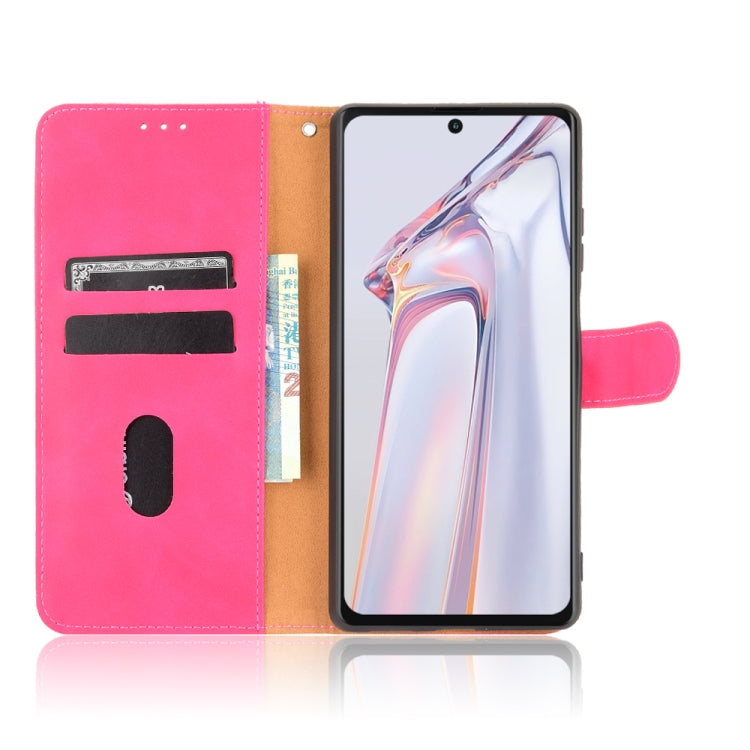 For Blackview A100 Solid Color Skin Feel Magnetic Buckle Horizontal Flip Calf Texture PU Leather Case with Holder & Card Slots & Wallet