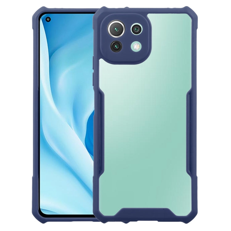 For Xiaomi Mi 11 Lite Acrylic + Color TPU Shockproof Case