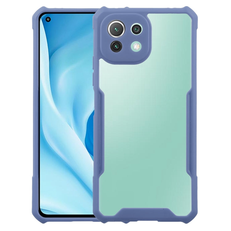 For Xiaomi Mi 11 Lite Acrylic + Color TPU Shockproof Case