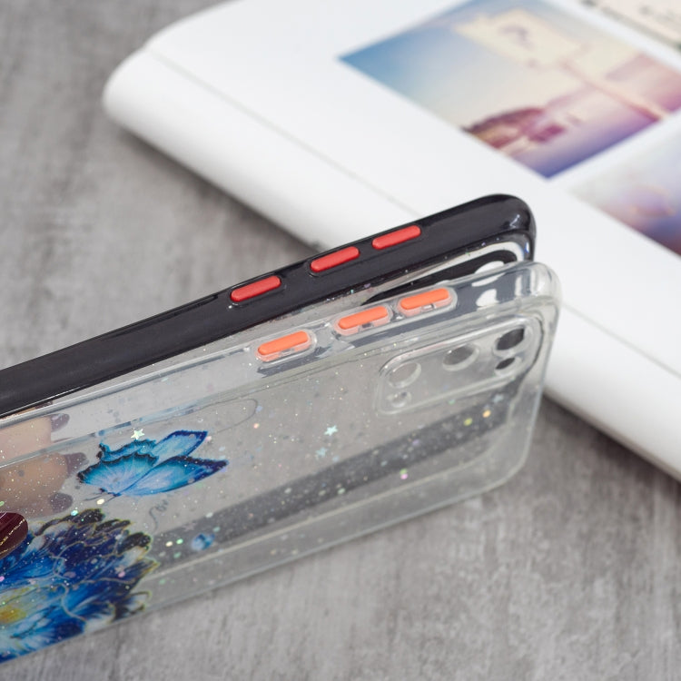 For Samsung Galaxy S20 Colored Drawing Starry Sky Epoxy TPU Shockproof Case with Neck Lanyard
