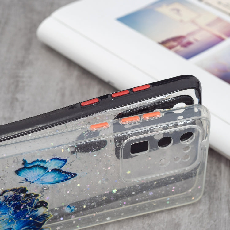 For Samsung Galaxy S20 Ultra Colored Drawing Starry Sky Epoxy TPU Shockproof Case with Neck Lanyard