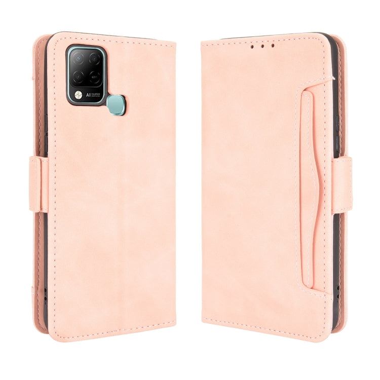 For Infinix Hot 10s/10s NFC/10T Skin Feel Calf Pattern Horizontal Flip Leather Case with Holder & Card Slots & Photo Frame